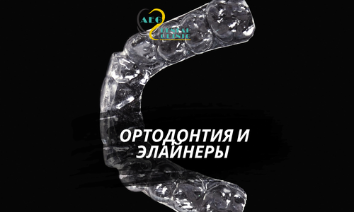 Ортодонтия и элайнеры