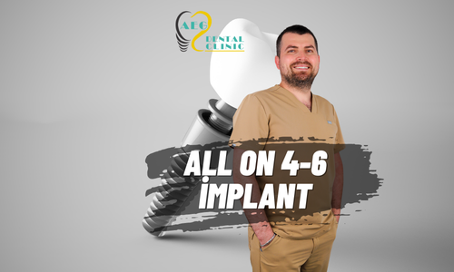 Hiç Dişi Olmayanlar İçin Sabit Dişler: All-on-4 ve All-on-6