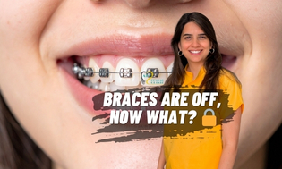 Life After Braces: Retention Guide