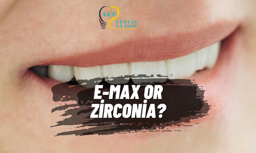 E-max or Zirconia?