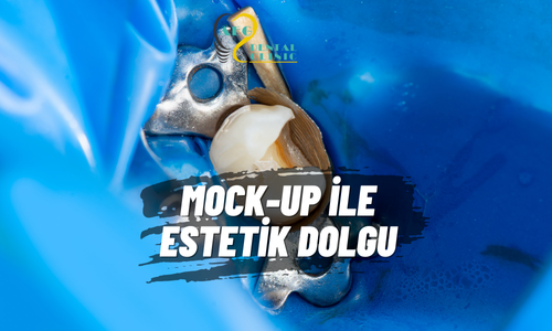 Sonucu Önceden Görün: Mock-up