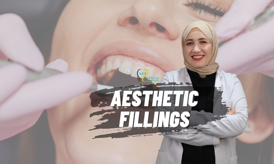 Composite Filling and Bonding