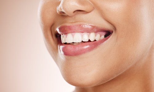 Домашнее отбеливание зубов