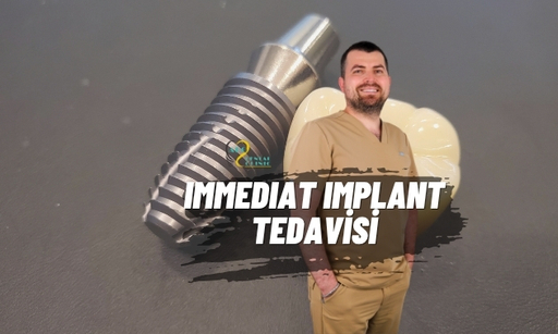 İmmediat İmplant (Tek Seansta İmplant Uygulaması)