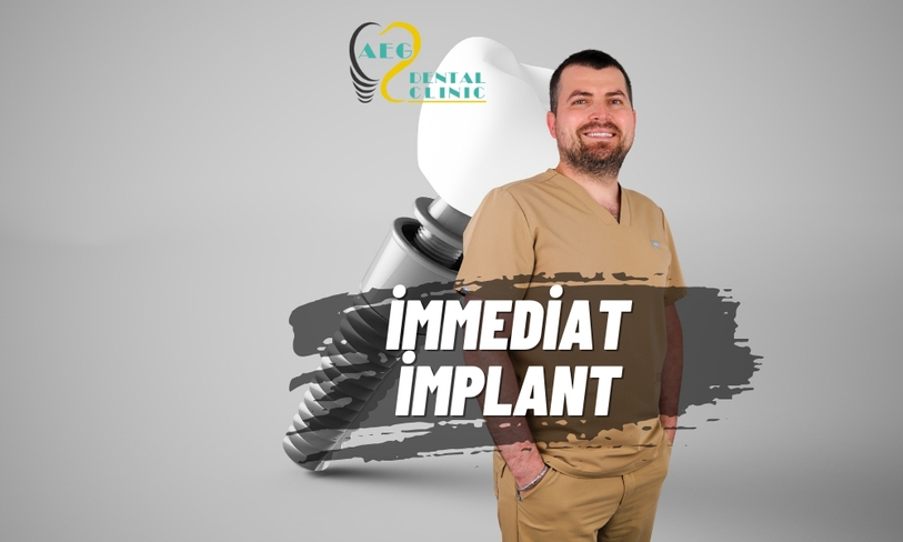 Tek Seansta İmplant: Diş Çekimi ve İmplant Aynı Anda