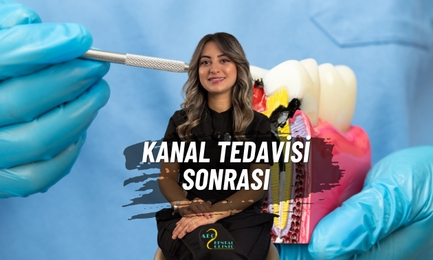Kanal Tedavisi Sonrası İyileşme Rehberi