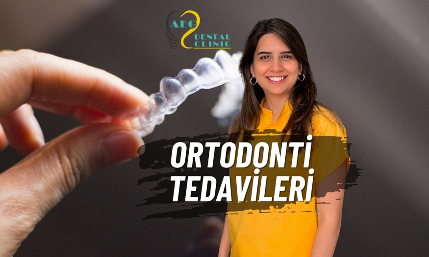 ORTODONTİ (DİŞ TELİ ve ŞEFFAF PLAK)