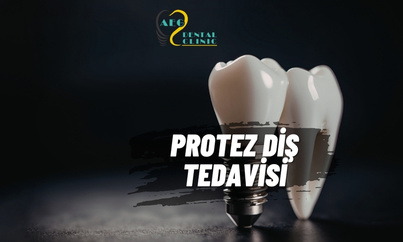 Protez Diş ve Imetric Teknolojisi