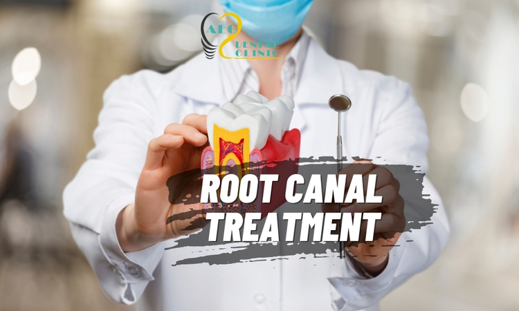 ROOT CANAL TREATMENT (Endodontics)
