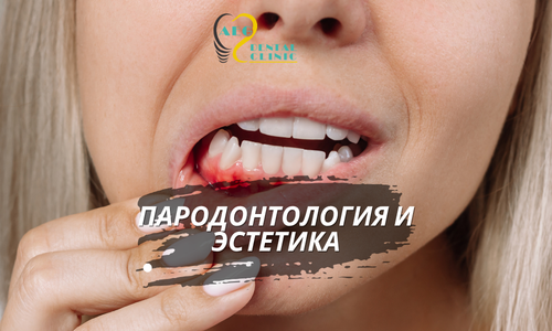 Пародонтология и эстетика