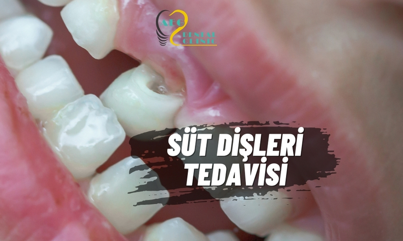 Süt Dişleri ve Gerçekler
