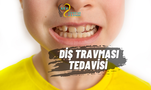 Çocuk Diş & Travma Tedavisi